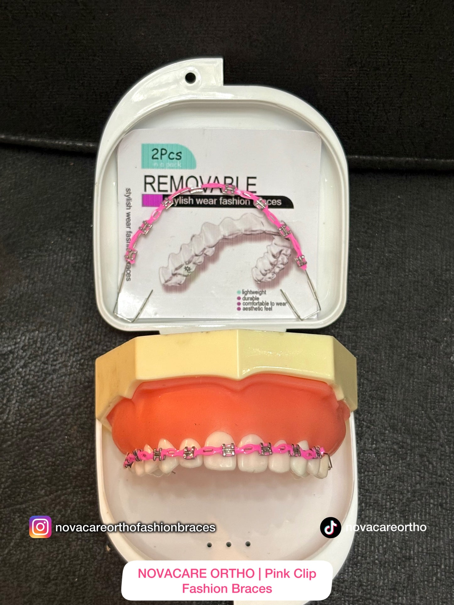 Clip Removable Braces🌟(Top & Bottom) – with Free Retainer Case🌟