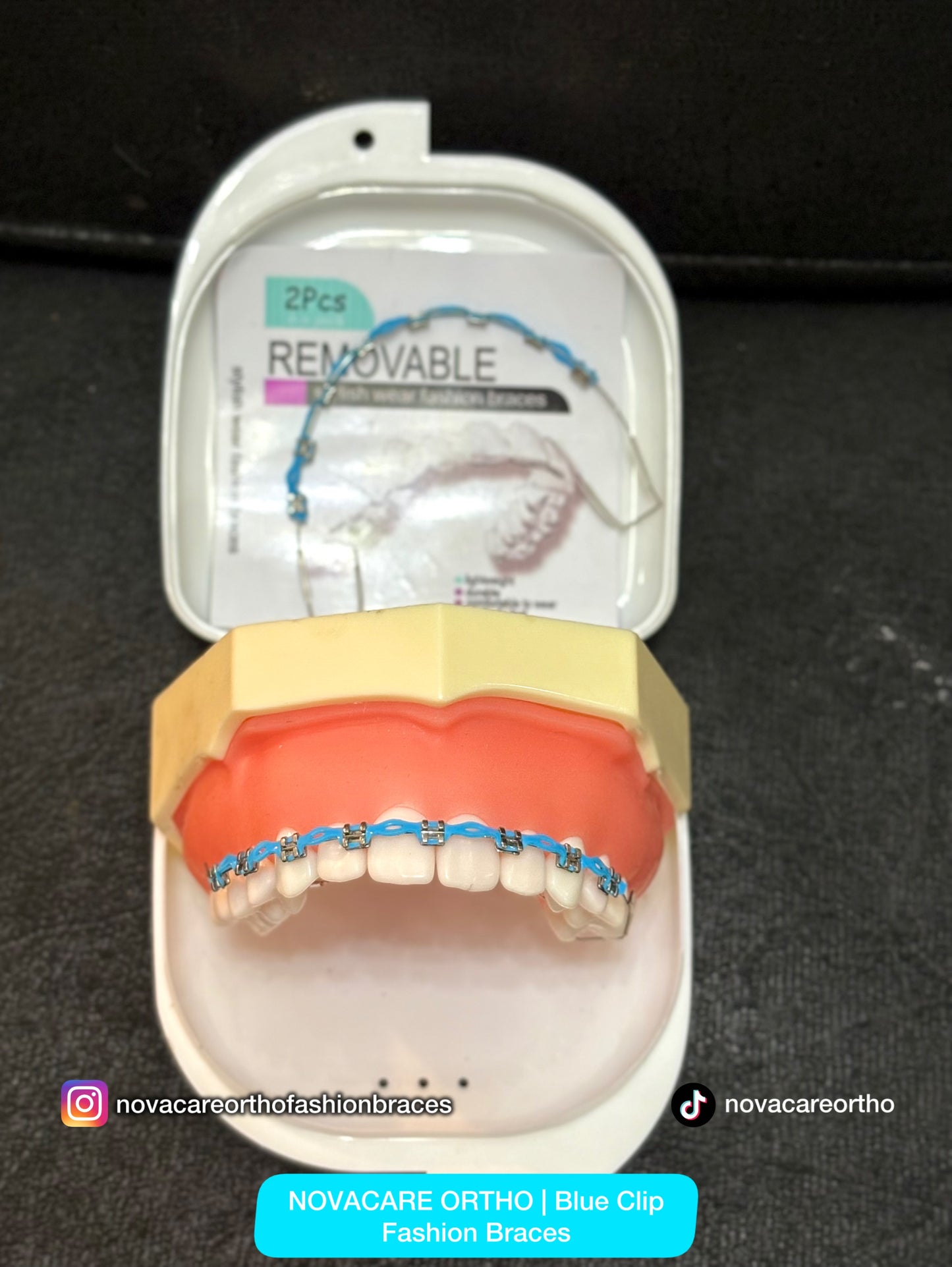 Clip Removable Braces🌟(Top & Bottom) – with Free Retainer Case🌟
