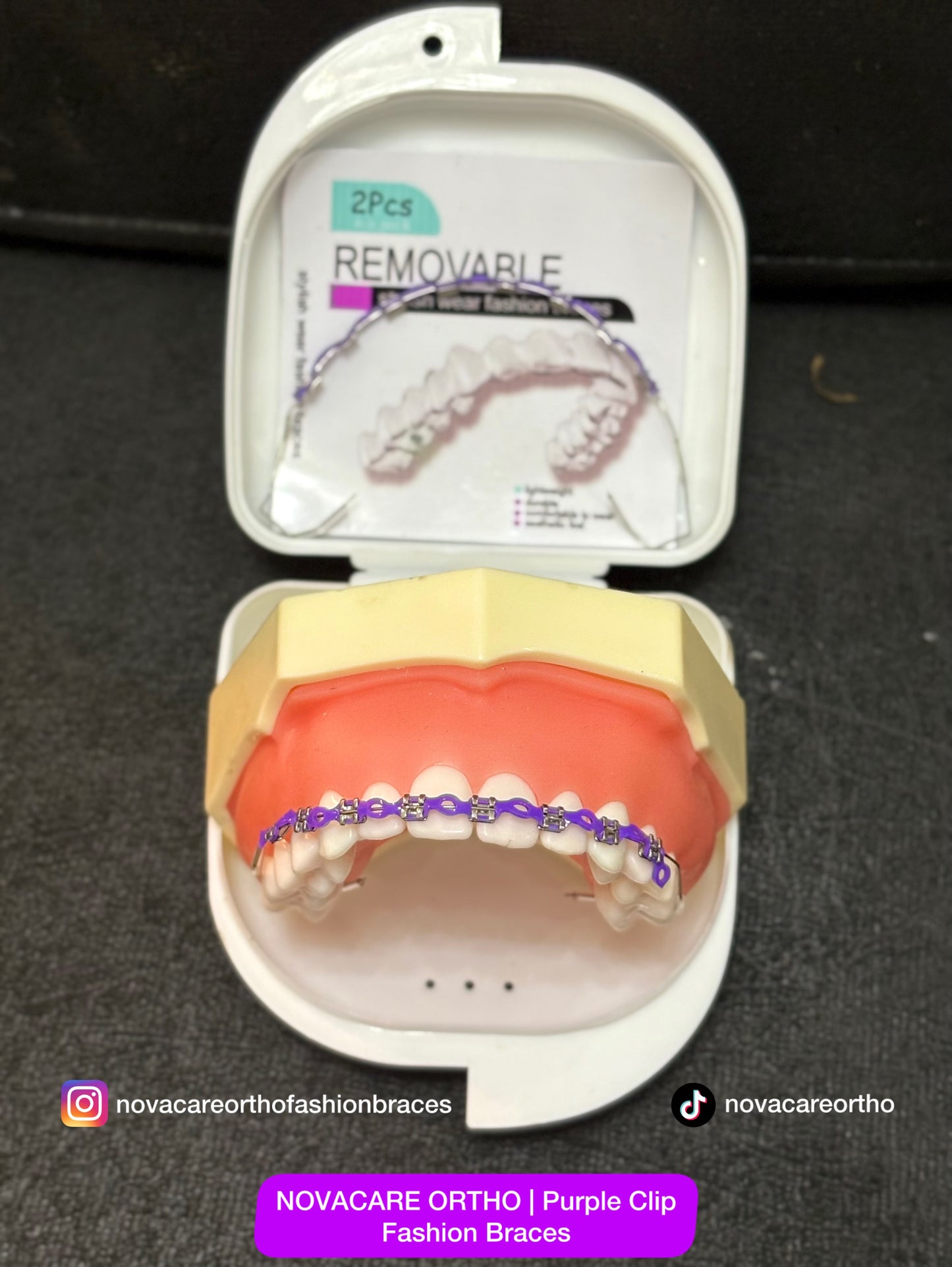 Clip Removable Braces🌟(Top & Bottom) – with Free Retainer Case🌟