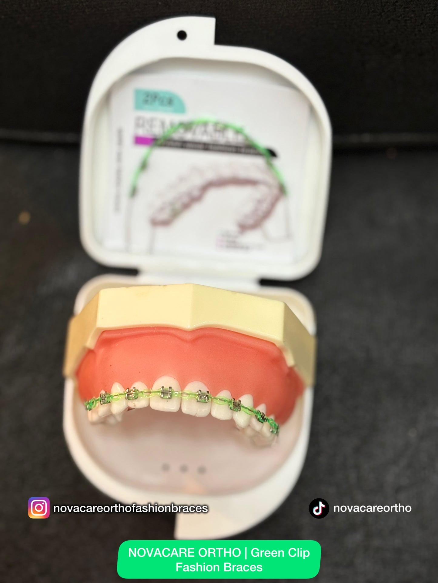 Clip Removable Braces🌟(Top & Bottom) – with Free Retainer Case🌟
