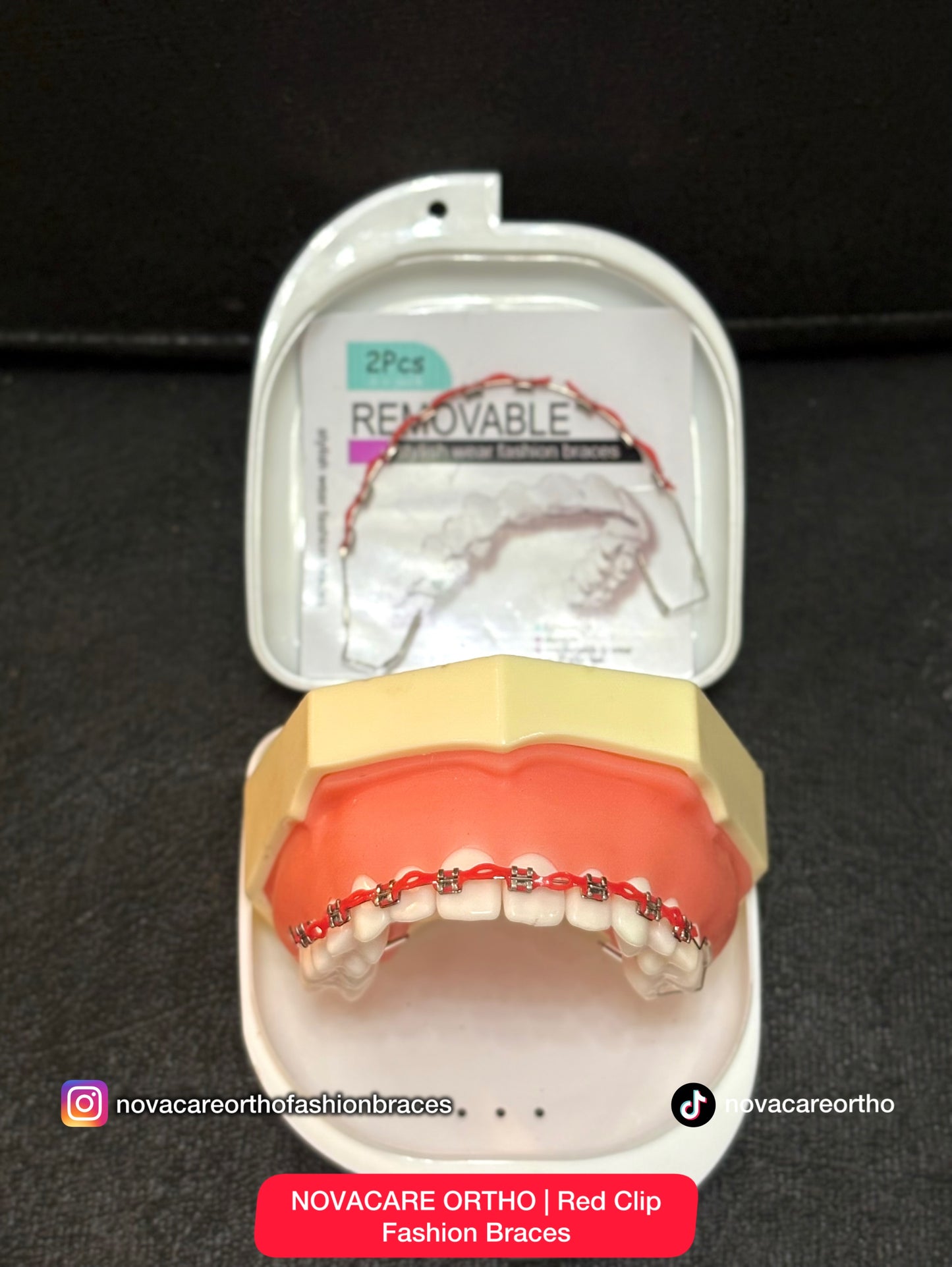 Clip Removable Braces🌟(Top & Bottom) – with Free Retainer Case🌟