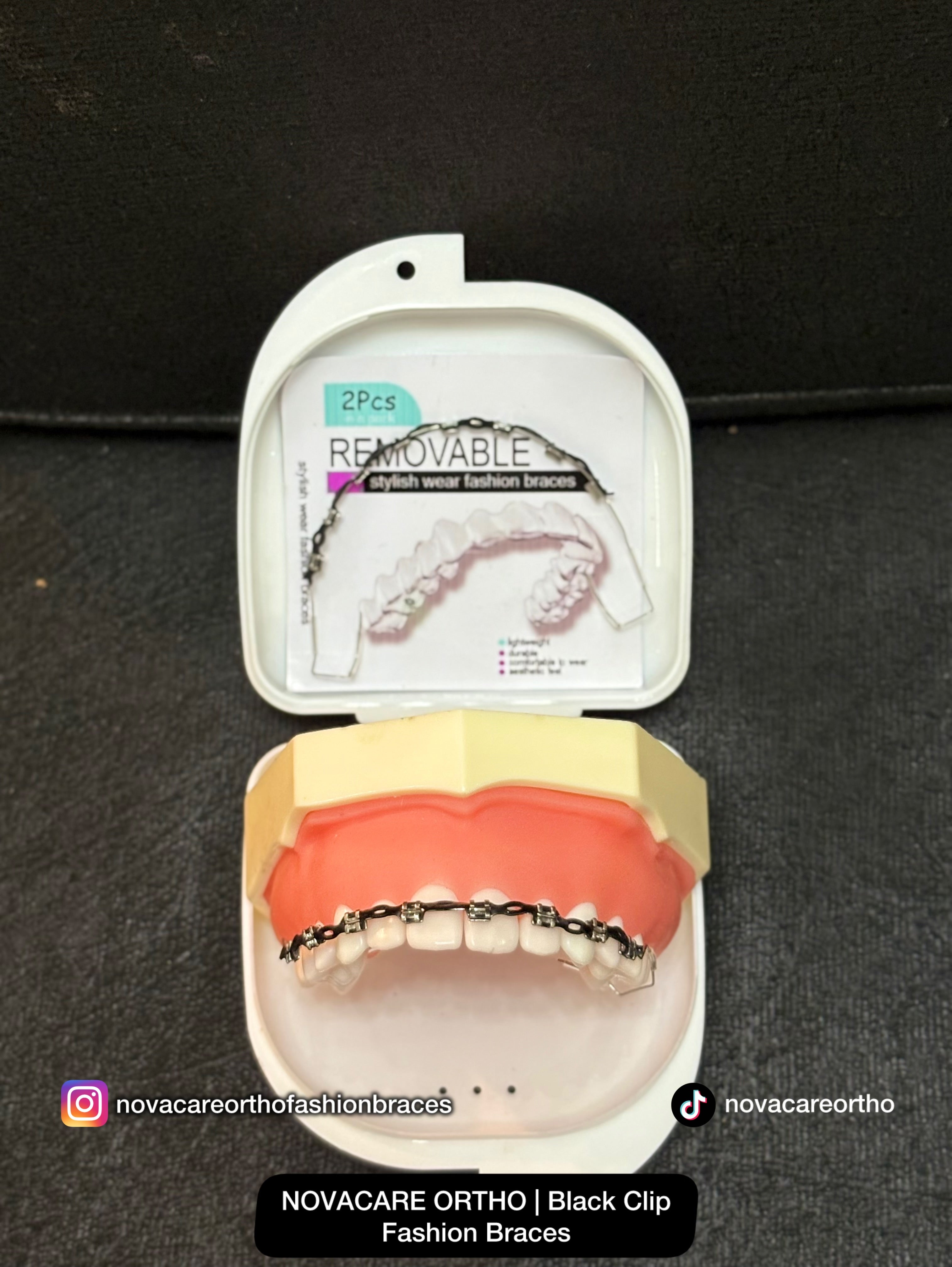Clip Removable Braces🌟(Top & Bottom) – with Free Retainer Case🌟