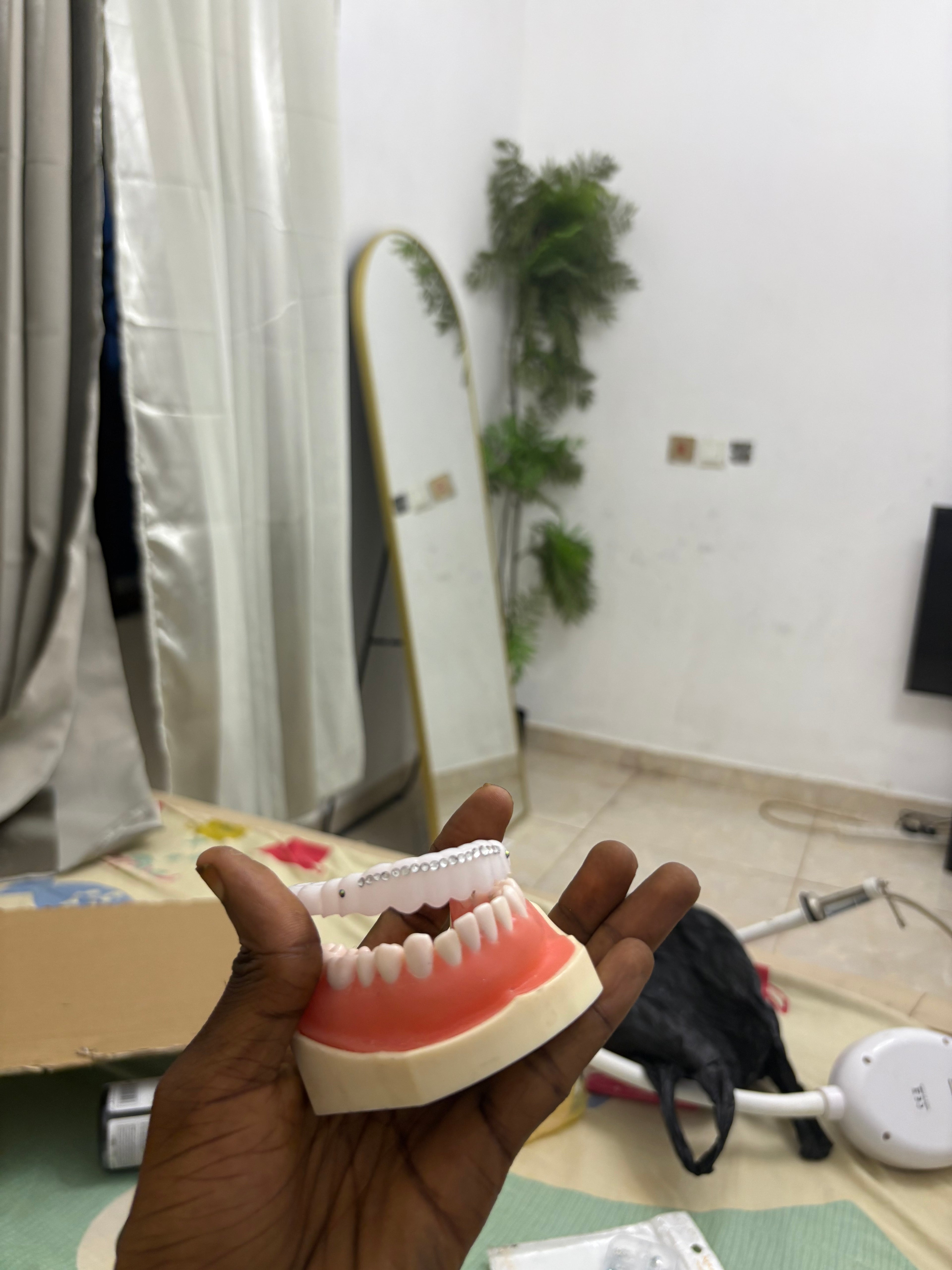 Gemstones Veneers