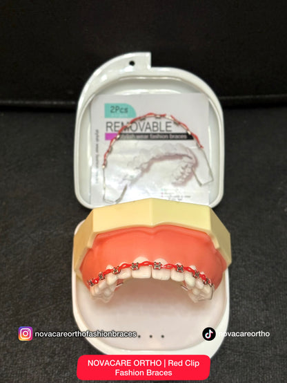 Clip Removable Braces🌟(Top & Bottom) – with Free Retainer Case🌟
