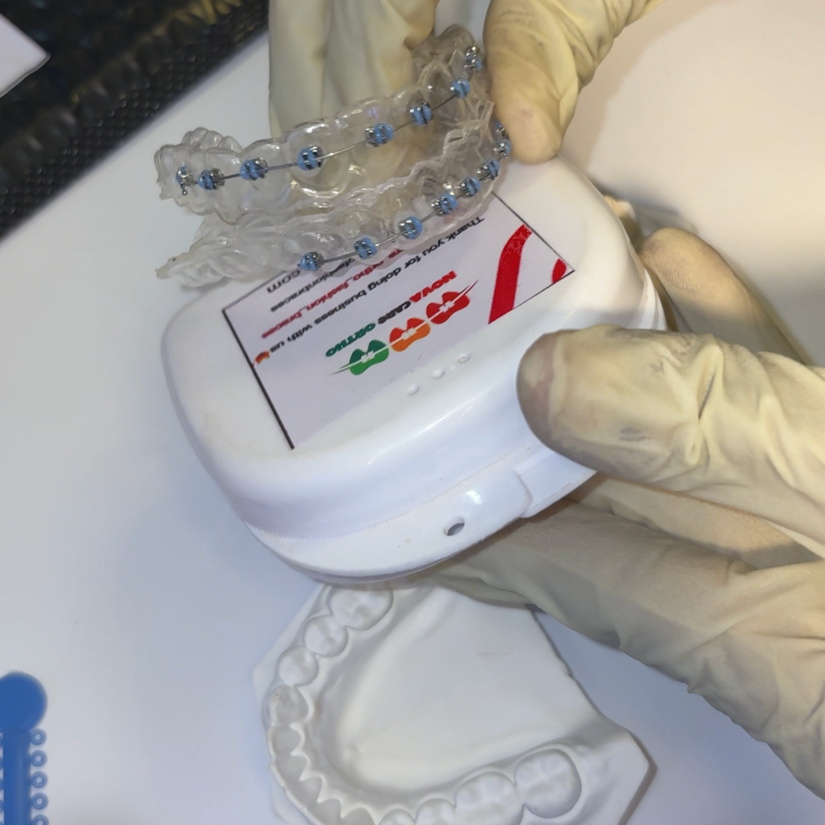 Custom-Made Fashion Retainer Braces