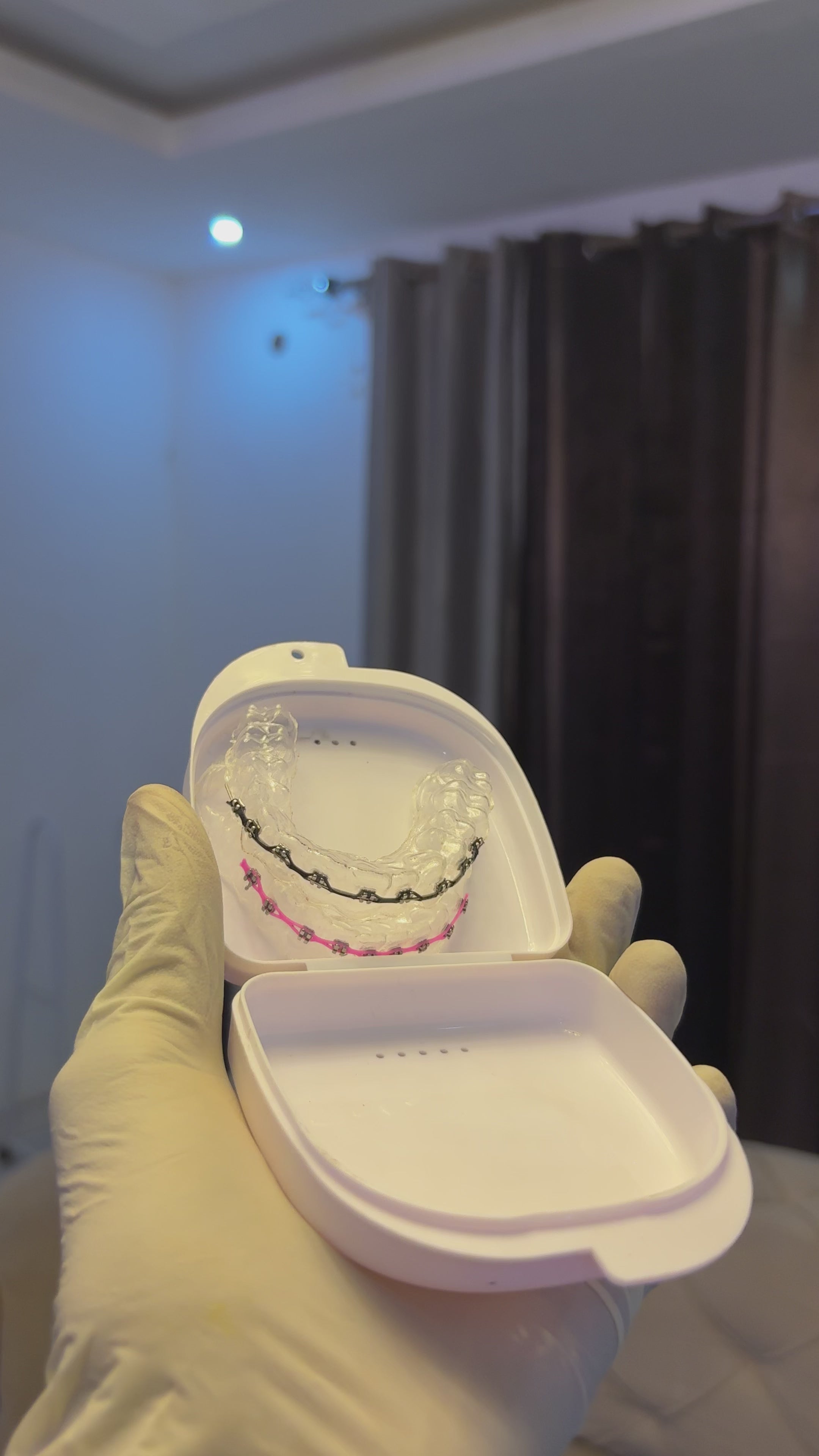 Custom-Made Fashion Retainer Braces